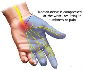 Avoiding carpal tunnel, neck, shoulder pains on walking desk